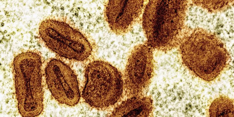 Prefeitura de Belém confirma morte de paciente por MPOX