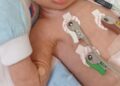 Bebê de 5 meses com síndrome de Down aguarda há 10 dias por leito de UTI em Belém