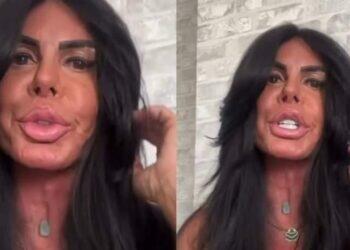 Aos 66 anos, Gretchen mostra rosto sem filtro e revela nova harmonização facial | Cultura