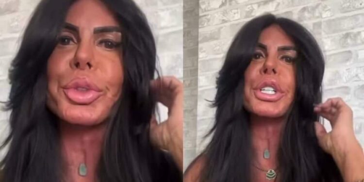 Aos 66 anos, Gretchen mostra rosto sem filtro e revela nova harmonização facial | Cultura