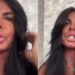 Aos 66 anos, Gretchen mostra rosto sem filtro e revela nova harmonização facial | Cultura