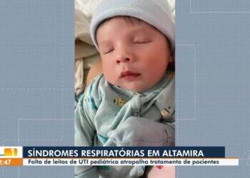 Após espera por leito, família aciona Justiça para conseguir vaga em UTI para bebê com pneumonia no Pará