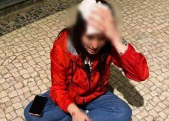 Brasileira leva pedrada na cabeça em Portugal após responder insulto: 'Fala baixo, vaca' | Brasil