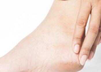 Calcanhar ressecado e rachado? Saiba como evitar e manter os pés macios e hidratados | Saúde