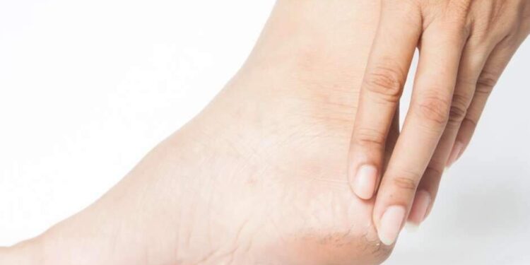 Calcanhar ressecado e rachado? Saiba como evitar e manter os pés macios e hidratados | Saúde