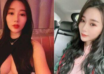 Modelo morre após usar “injeção de leite” para tratar insônia crônica; entenda | Mundo