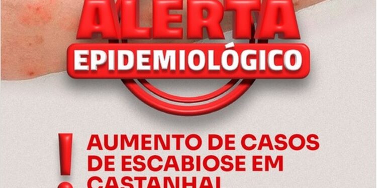 Castanhal emite alerta para aumento de casos de sarna; veja como se proteger | Pará