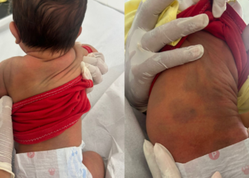 Homem é preso após agressão contra mulher e filho recém-nascido de três dias, no Pará