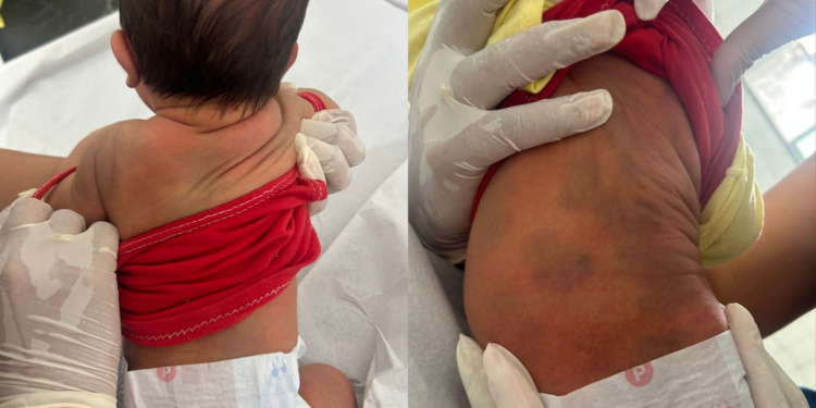 Homem é preso após agressão contra mulher e filho recém-nascido de três dias, no Pará