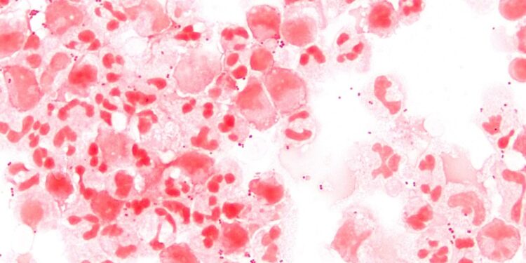 Caso de meningite é confirmado em estudante da UFPA em Belém